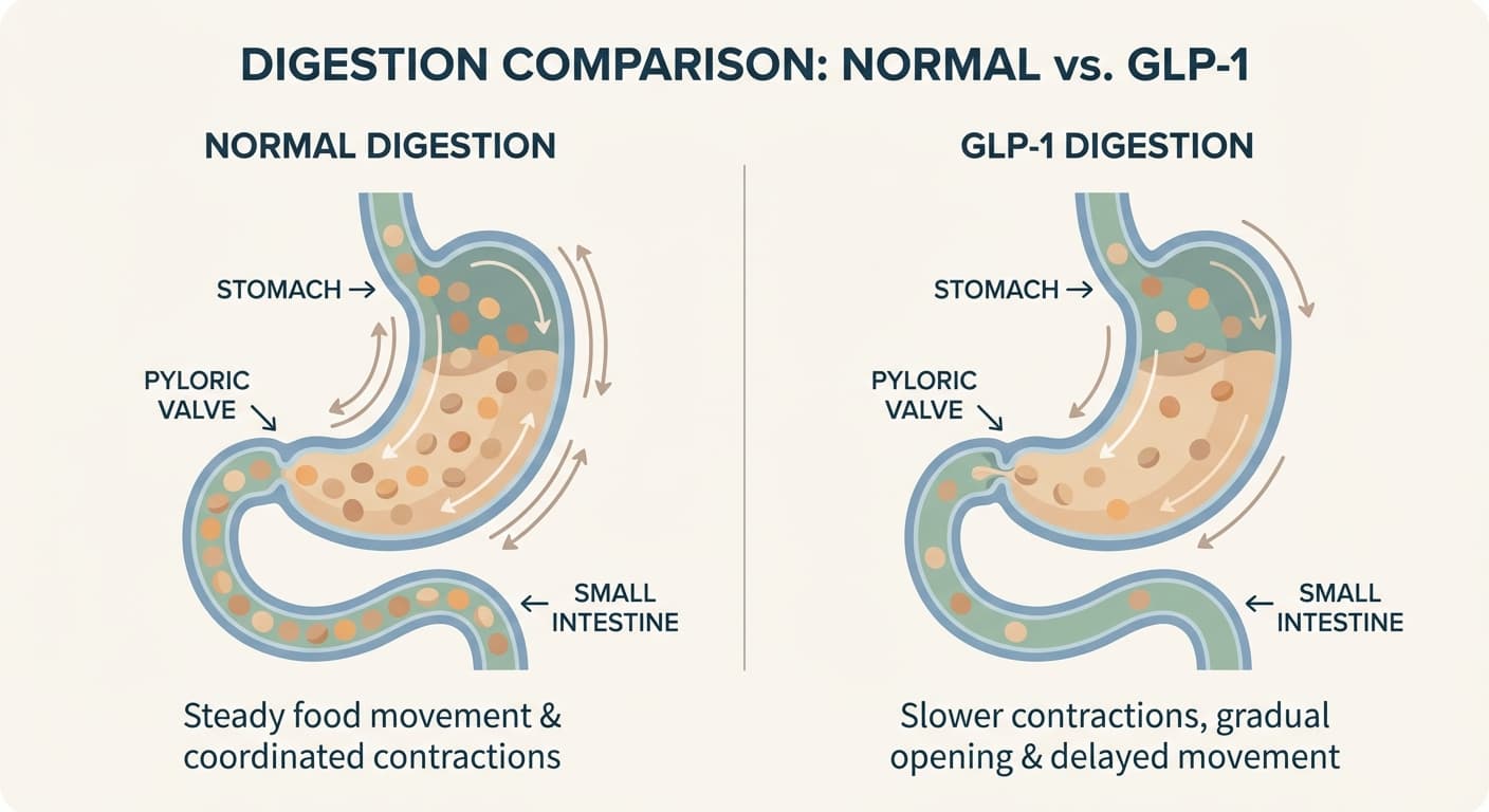 Digestion comparison: Normal vs GLP-1 - showing how food moves through the stomach more slowly with GLP-1 medications